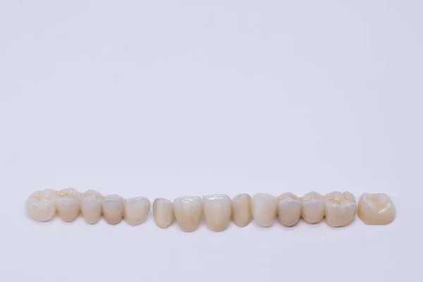 Οδοντική γέφυρα απομονωμένη σε γουάιτ από κεραμική πορσελάνη. Αισθητική αποκατάσταση της απώλειας δοντιών. Κεραμικό ζιρκόνιο. Κεραμικές οδοντιατρικές κορώνες χωρίς μέταλλα. — Φωτογραφία Αρχείου