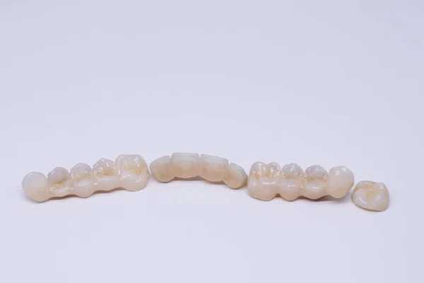 Bellissimi denti in ceramica. Corona e ponte in porcellana. Ponte in ceramica dentale su sfondo bianco. Corone dentali in ceramica senza metallo. — Foto Stock