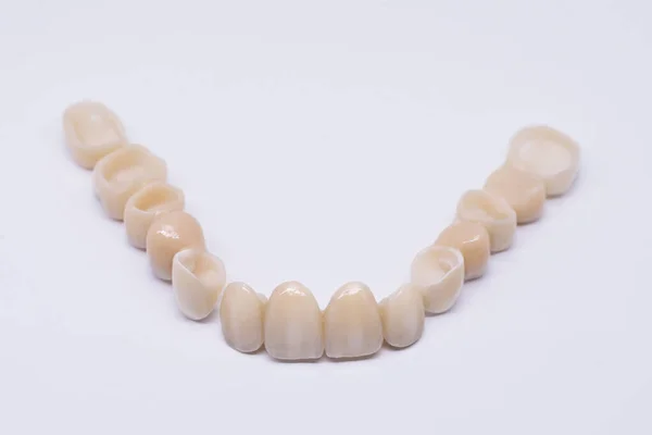 Piękny most stomatologiczny izolowany na wite z ceramicznej porcelany. Estetyczne przywrócenie utraty zębów. Ceramiczny cyrkon w wersji końcowej. Ceramiczne korony dentystyczne bez metalu — Zdjęcie stockowe