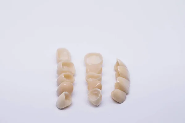 Zircônio cerâmico na versão final. Metal livre de cerâmica coroas dentárias. Coroa de dente de zircônio Isolar no fundo wite. Restauração estética da perda dentária. — Fotografia de Stock