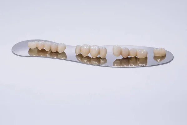 Coroa de dente de zircônio isolada no fundo de wite. Restauração estética da perda dentária. zircônio cerâmico na versão final. Coroas dentárias de cerâmica livre de metal — Fotografia de Stock