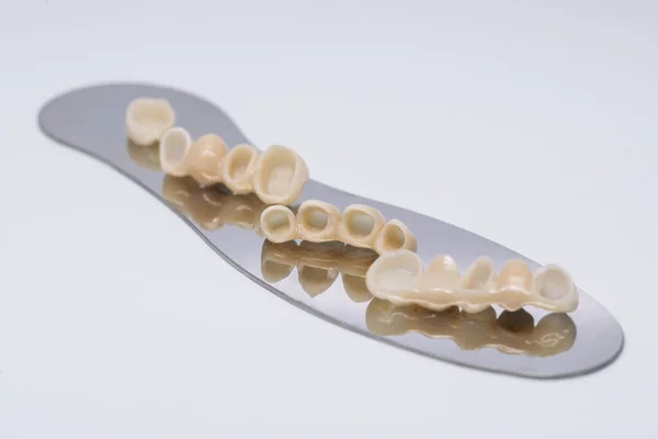 Zirconio corona dei denti Isolato su sfondo bianco. Ripristino estetico della perdita del dente. Corone dentali in ceramica senza metallo. — Foto Stock