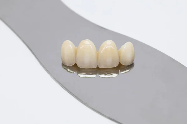 Metal free ceramic dental crowns — Stock Photo, Image