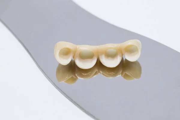 Metal free ceramic dental crowns. Dental ceramic veneers and crowns — Stock Photo, Image