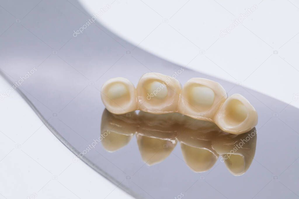 Dental ceramic veneers and crowns. Metal free ceramic dental crowns.