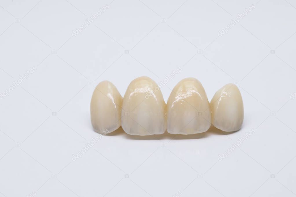 Dental ceramic bridge on isolated wite background. Metal free ceramic dental crowns.