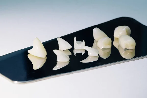Keramischer Zahn mit einem total klugen Hintergrund. Keramische Zähne mit Veneers. Keramische Zähne aus freiem Metall — Stockfoto