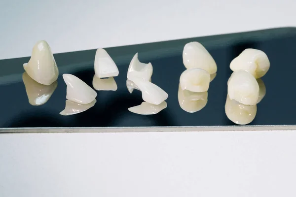 Zirconium crowns veneers. Ceramic teeth with the veneers isolated on white background — Zdjęcie stockowe