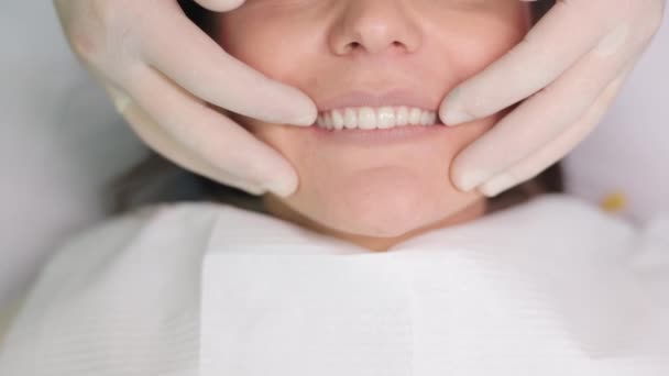 Processo de instalação de folheados. Veneers cenário na odontologia moderna. Close-up tiro de paciente do sexo feminino na cadeira com folheados de porcelana procedimento de instalação. Dental e conceito de cuidados dentários — Vídeo de Stock