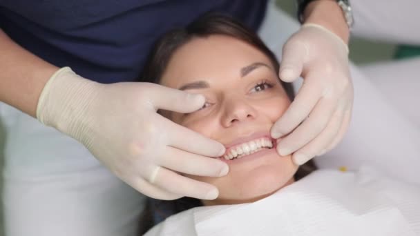 Impiallacciature dopo la fissazione. Impiallacciature di odontoiatria estetica. Moderna attrezzatura dentale e procedura di installazione di faccette in clinica dentale. — Video Stock