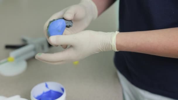 Hacer una plantilla para chapas temporales. Técnico dental haciendo dentadura postiza en un laboratorio dental. Cirujano oral haciendo impresiones de cera — Vídeos de Stock