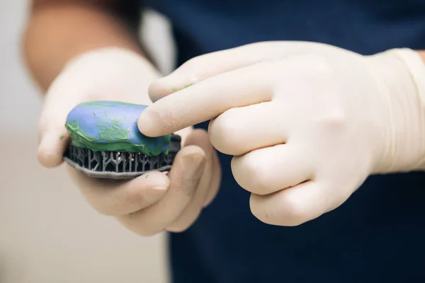 Técnico dentário a fazer dentadura num laboratório dentário. Fazendo um modelo para folheados temporários com silicone A e modelo 3D de plástico impresso. Cirurgião oral fazendo impressões de cera — Fotografia de Stock