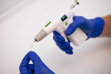 Endodontik tedavi sırasında kanal tıkanıklığı. Endodontik aletler kapanıyor. Modern teknoloji.