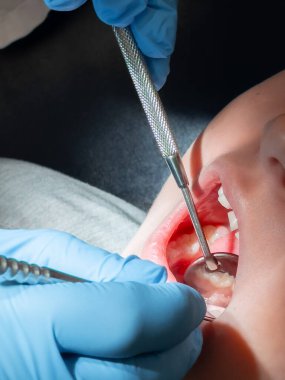 Beyaz bir çocuk ayna ve diş aletleriyle diş muayenesi yaptırıyor. Yüksek kalite.