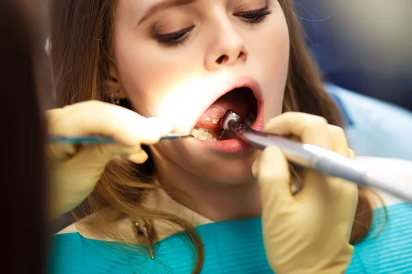 预防蛀牙的概述。牙科手术期间坐在牙医椅上的妇女. — 图库照片