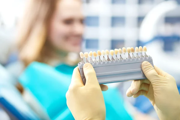 Mooie Europese vrouw glimlach met gezonde tanden bleken. Dental Care concept. — Stockfoto