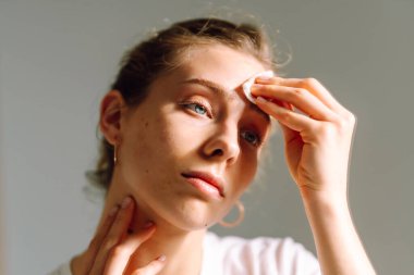 Genç bir kadının aynaya bakarken yüzüne pamuk pedlerle makyaj yaptığı yakın plan. Sıcak bir odada yüzünü önemseyen güzel bir kadın. Güzellik ve cilt bakımı, cilt bakımı.