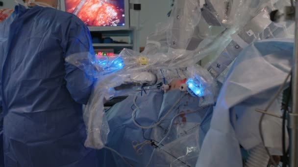 Cirugía robótica mínimamente invasiva con el sistema quirúrgico Da Vinci — Vídeo de stock