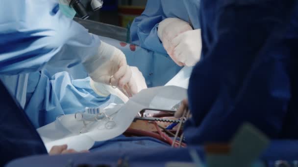 Cirurgiões durante uma cirurgia cardíaca aberta — Vídeo de Stock