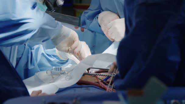 Chirurgiens lors d'une chirurgie à cœur ouvert — Video