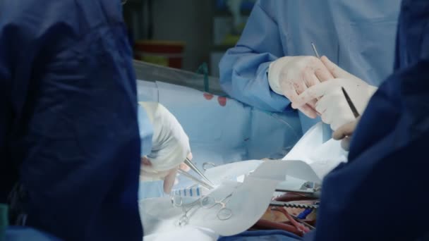 Хирурги во время операции на открытом сердце — стоковое видео