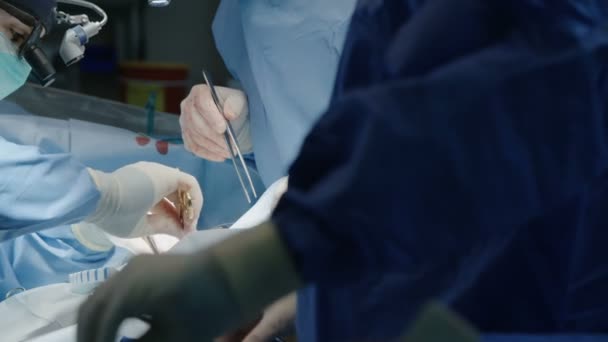 Chirurgiens lors d'une chirurgie à cœur ouvert — Video