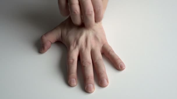Un hombre adulto sin rostro se rasca la mano, que está aislada sobre un fondo blanco con un espacio de copia. Hay signos de dermatitis y sarna en la mano. El concepto de alergia a la piel. Vista superior. 4K — Vídeos de Stock
