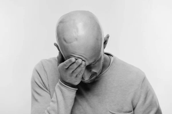 Skallig Man Psykologisk Stress Kämpar För Livet Fjärdedel Hjärntumör Hjärtskärande — Stockfoto
