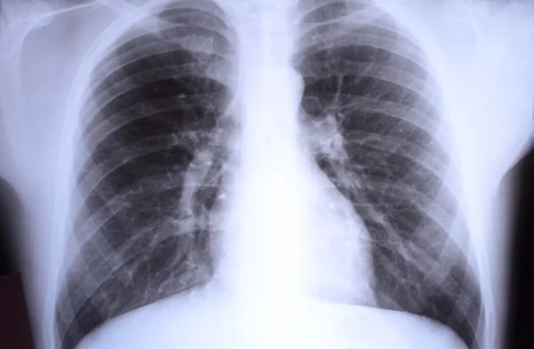 Vista de una radiografía infantil — Foto de Stock