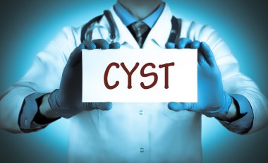 Doctor keeps a card with the name of the diagnosis - cyst clipart