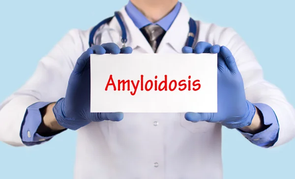 O doutor guarda um cartão com o nome do diagnóstico - amiloidose — Fotografia de Stock