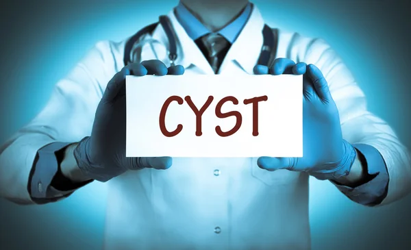Doktor tanı adı ile bir kart tutar - kist