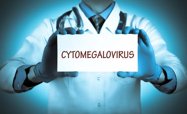 Doktor tutar ile tanı - adını kartı Sitomegalovirüs