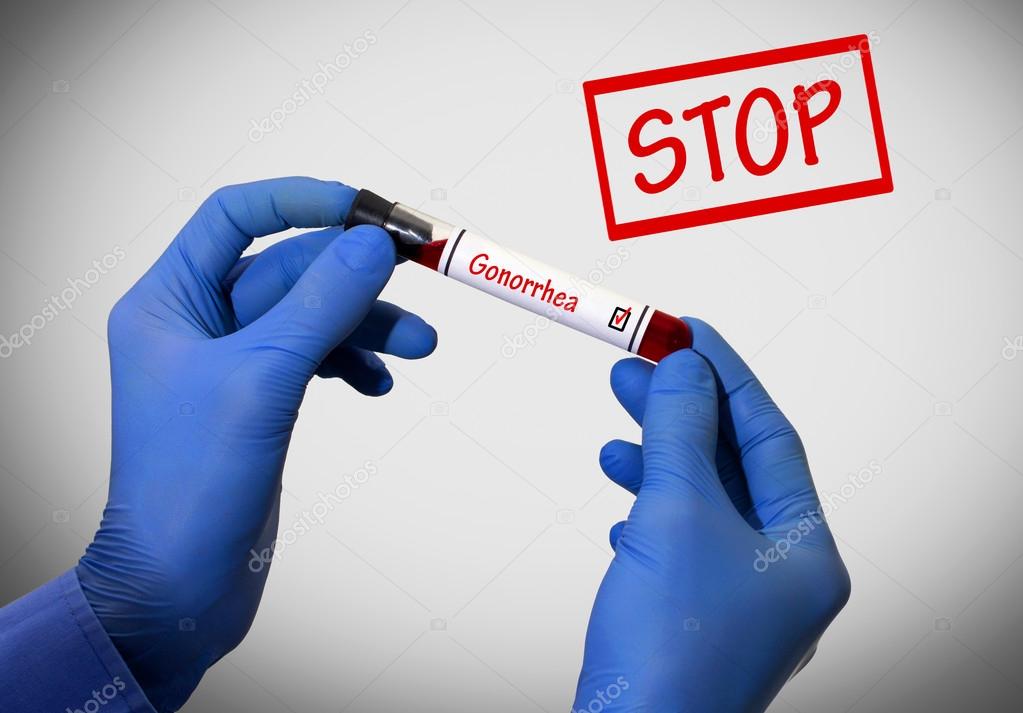 Stop gonorrhea. Positive result of blood test. Test tube with a blood