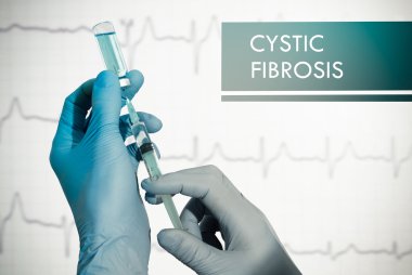 Kistik fibrozis durdurmak