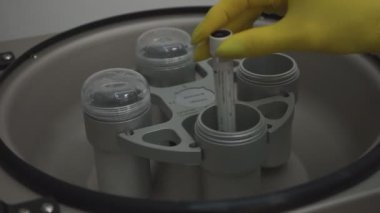 Test tüpleri bir laboratuvar çalışanı tarafından biyokimyasal analiz cihazına yerleştiriliyor.