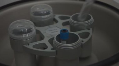 Test tüpleri bir laboratuvar çalışanı tarafından biyokimyasal analiz cihazına yerleştiriliyor.