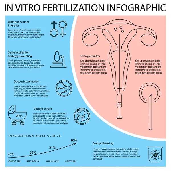 Infográfico de fertilização in vitro . —  Vetores de Stock