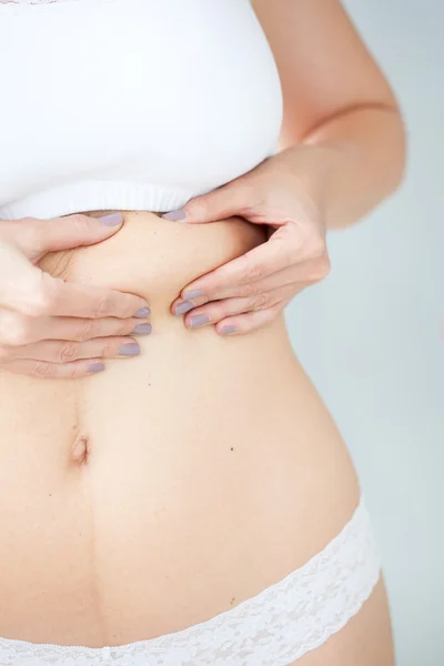 Grasa localizada en el abdomen de la mujer —  Fotos de Stock