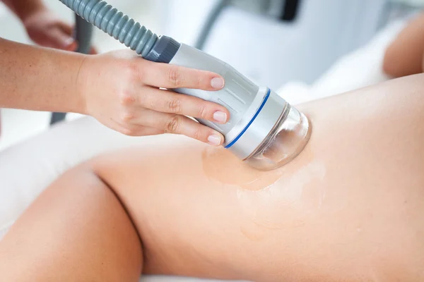 Kadının bacak deri altı tedavisi