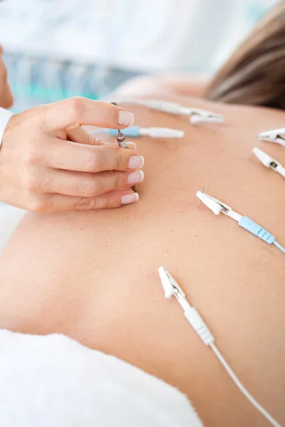 Bir hastanın sırtına uygulanan electroacupuncture doktor