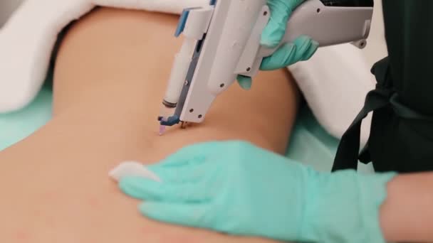 Kadın Müşterinin Sırtına Yapılan Enjeksiyonlarla Yapılan Mezoterapi Prosedürü Güzellik Uzmanı — Stok video