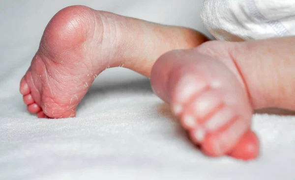 Маленькие новорожденные белые кожные ноги на белом фоне — стоковое фото
