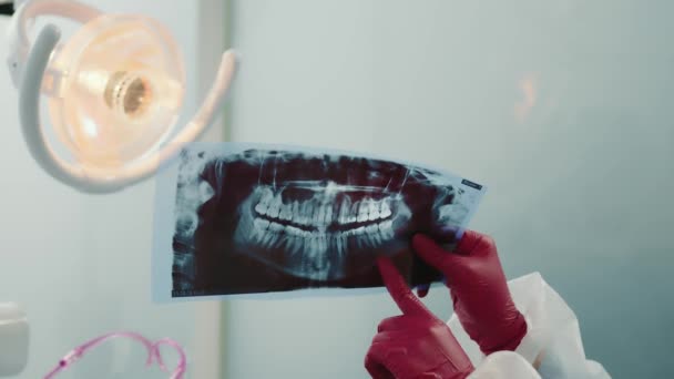 Dentysta bada panoramiczne prześwietlenie zębów. Dentysta pokazuje problem zębów na prześwietleniu zębów palcem.. — Wideo stockowe