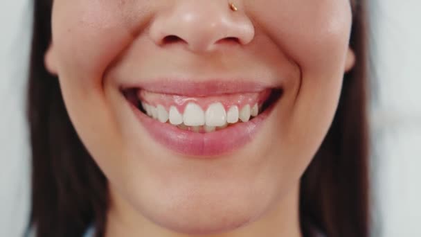 笑一个迷人的女孩与完美的白色牙齿接近。完美的白牙和微笑. — 图库视频影像