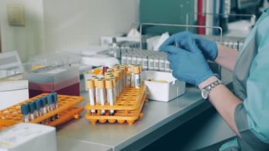 Laboratuvar asistanı kan tüplerini antikorlar için mikrobiyolojik analiz için hazırlıyor. Kadınların ellerinin yakın plan çekimleri test tüplerini açar ve onları özel bir tripoda yükler.