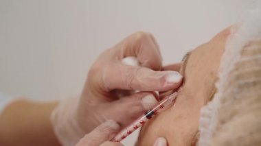 Mezoterapi. Yakın çekim. Güzellik uzmanı hastaların yüzüne iğne yapar. Dudak büyütme prosedürü, yüzündeki kırışıklıkların azaltılması, cilt yenileme, yüz gerdirme..