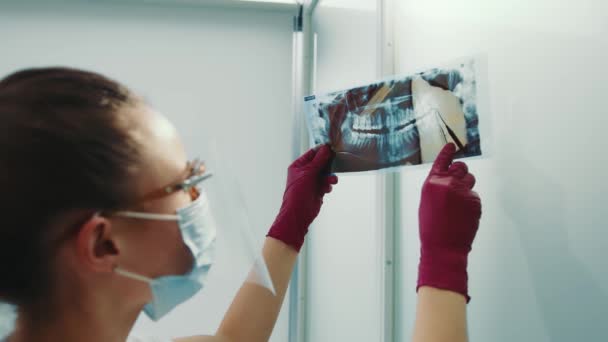 Врач, изучающий панорамную компьютерную томографию и рентген человеческих зубов. — стоковое видео