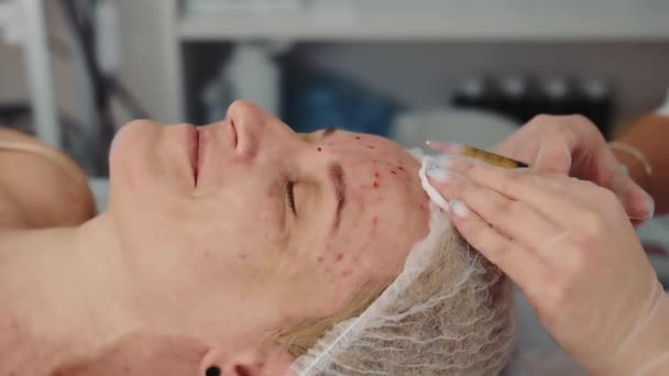 El esteticista realiza un procedimiento de lifting facial. El médico inyecta un medicamento debajo de la piel para restaurar la piel facial en los ancianos. Procedimiento de mesoterapia — Vídeos de Stock