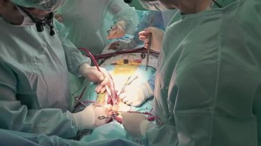 Cerrahlardan oluşan bir ekip kalp ameliyatı yapıyor, profesyonel bir tıbbi operasyon..